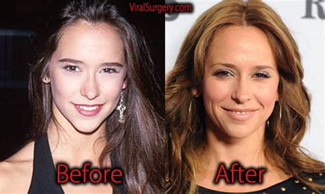 jennifer love hewitt breast reduction|Jennifer Love Hewitt Responds to Plastic Surgery。